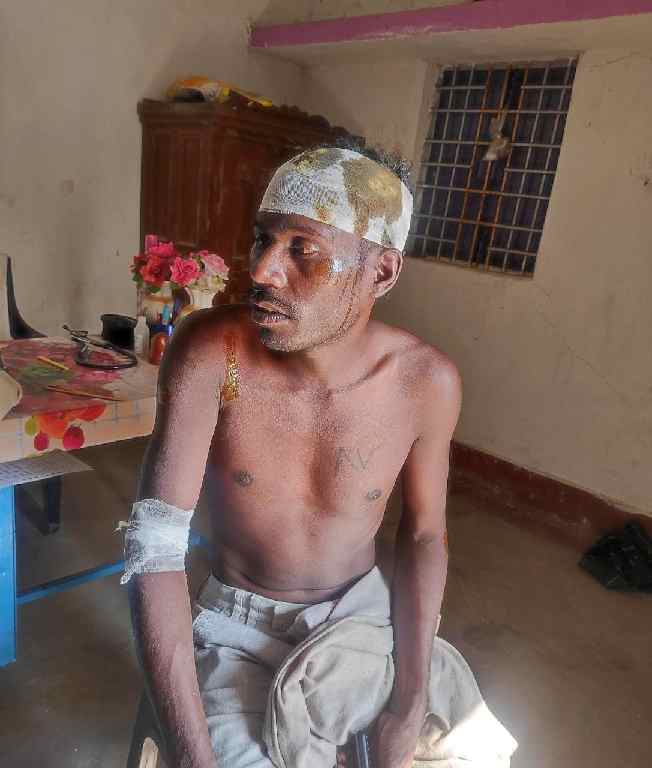 सरकारी नल में पानी को लेकर सिर फुटौव्वल किया , घरघोड़ा थाना में मामला दर्ज 1 IMG 20230312 100054