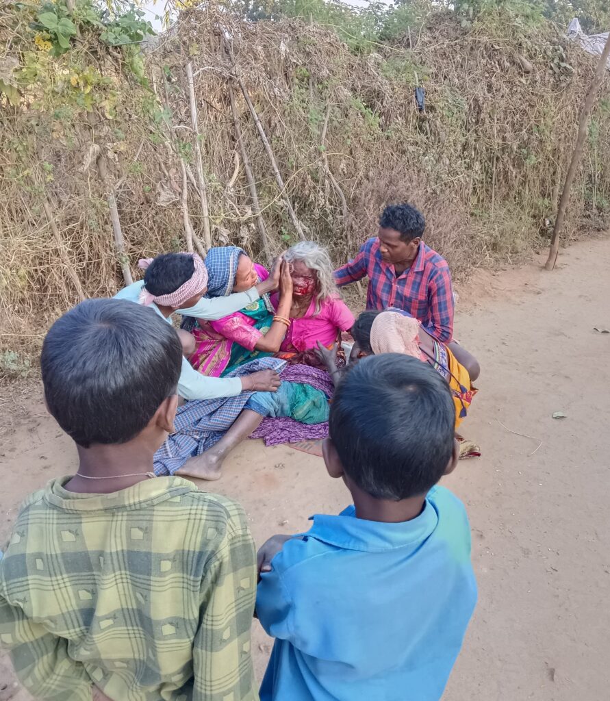 नशे में धुत पोता ने अपनी दादी का आंख फोड़ा 1 IMG 20250111 WA00352