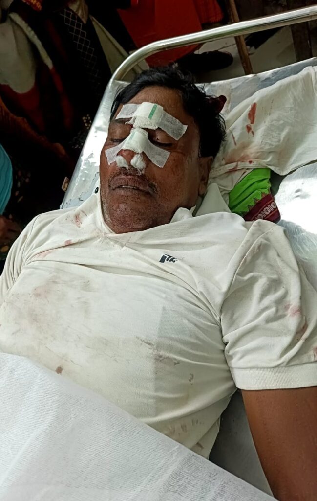 सड़क हादसे मे नगर पंचायत के पूर्व उपाध्यक्ष का निधन , नगर में शोक की लहर 1 IMG 20250829 WA00102